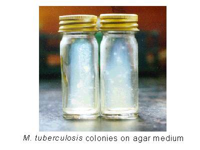 M. tuberculosis colonies on agar medium