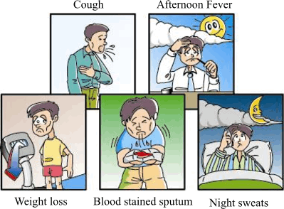 Symptoms of Tuberculosis: Cough, Afternoon fever, Weight loss, Blood stained sputum and Night sweats