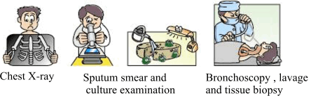 Chest X-ray, Sputum smear and culture examination, Bronchoscopy, lavage and tissue biopsy