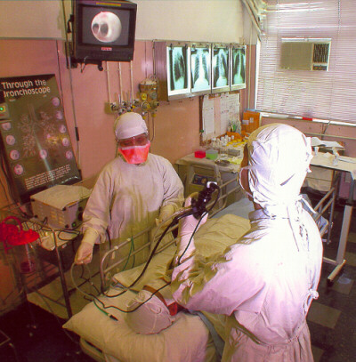 Fiberoptic bronchoscopy