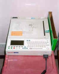 ECG