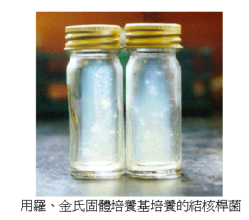 用罗、金氐固体培养基培养的结核杆菌