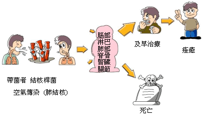 结核病（俗称肺痨病），是肺部受「结核杆菌」侵袭的疾病。开放性结核病带菌者会将带有结核杆菌的飞沬经空气传染给别人。除了肺部外，它亦可以侵袭其他器官，如淋巴、骨骼、关节、脊骨、脑部、肾脏等。如果及早治疗则会痊愈，否则会导致死亡。