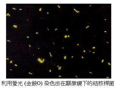 利用螢光(金銨O)染色法在顯微鏡下的結核桿菌