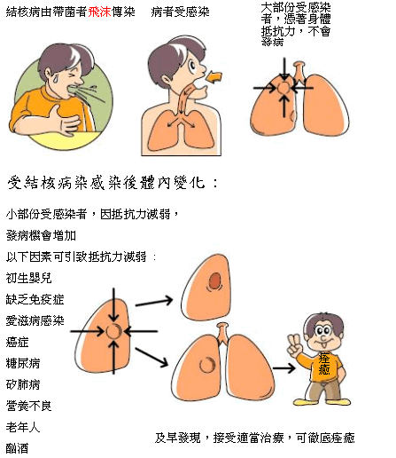 受結核桿菌感染後有甚麼後果: 結核病由帶菌者飛沫傳染->病者受感染->大部份受感染者,憑著身體抵抗力,不會發病。受結核病感染後體內變化: 小部份受感染者,因抵抗力減弱,發病機會增加。以下因素可引致抵抗力減弱: 初生嬰兒; 缺乏免疫症; 愛滋病感染; 癌症; 糖尿病; 矽肺病; 營養不良; 老年人; 酗酒->及早發現,接受適當治療,可徹底痊癒。
